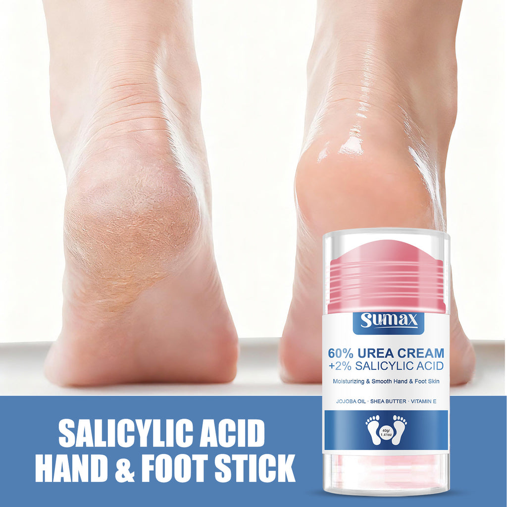 Voyage Queens - Salicylic Acid Foot and Hand Cream - Voyage Queens